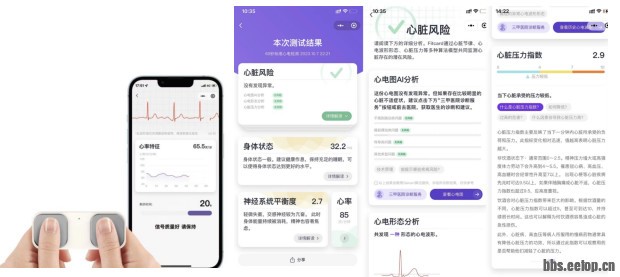 苏州唯理家用心电仪FitCard入驻联通智家，为联通用户提供居家心脏健康管理服务