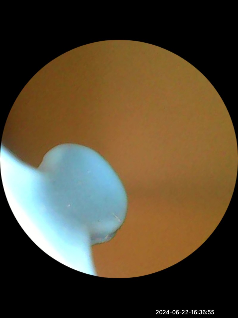 西圣Find智能可视耳勺体验！所见所得，可以有一个大胆的想法