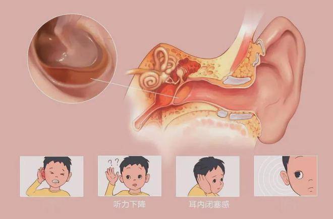 骨传导耳机哪个牌子比较好？盘点2025年度5大热门骨传导耳机推荐