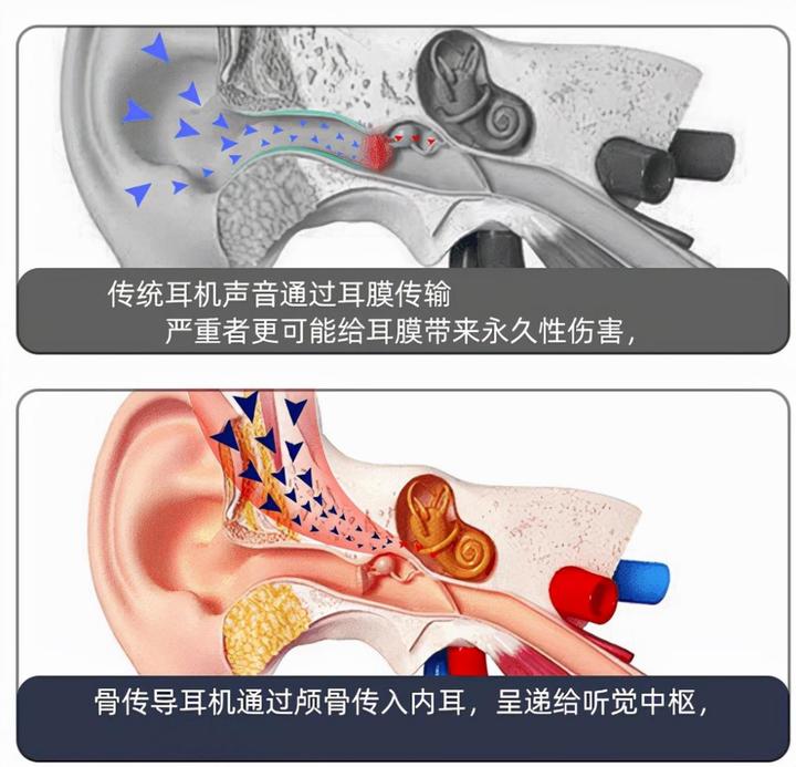 你知道哪种耳机对耳朵伤害最小吗？久戴不痛的蓝牙耳机排行