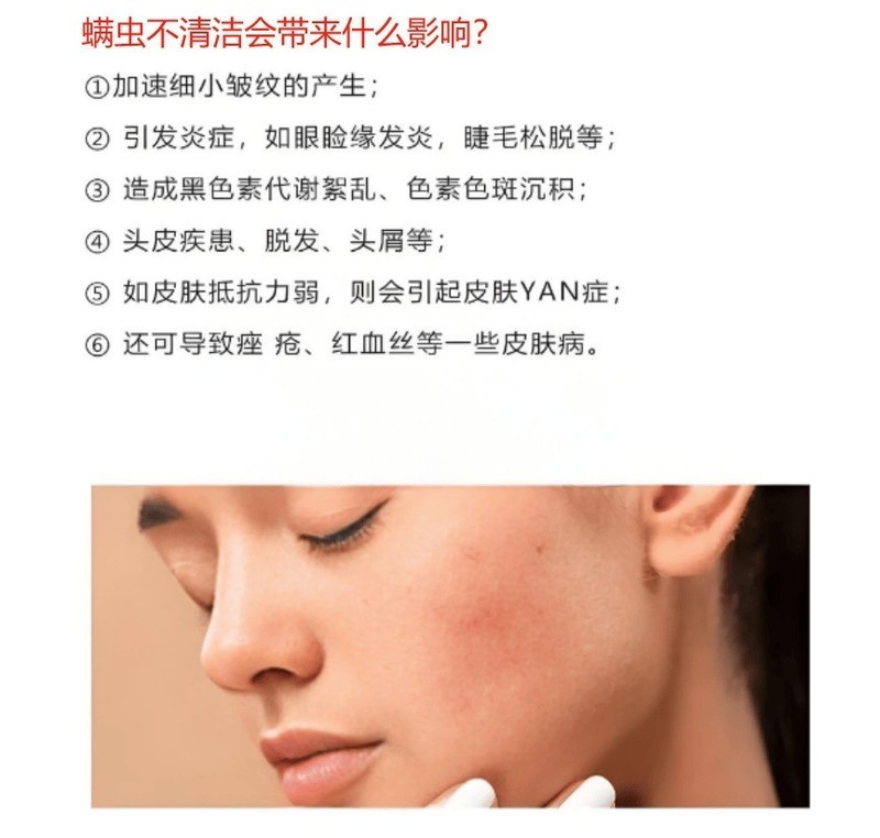 520送情 侣对象除螨仪合适吗？五大高人气除螨仪品牌种草！