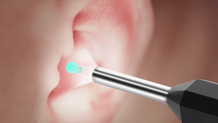 比较推荐哪种可视耳勺？推荐2024年4款超赞口碑产品