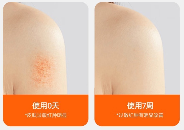 除螨仪智商税还是真香？2025年5 款热门机型拆解，原来选对这么重要！