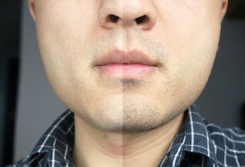 五刀头狂魔配置 尽享清爽——未野MRX往复式剃须刀体验