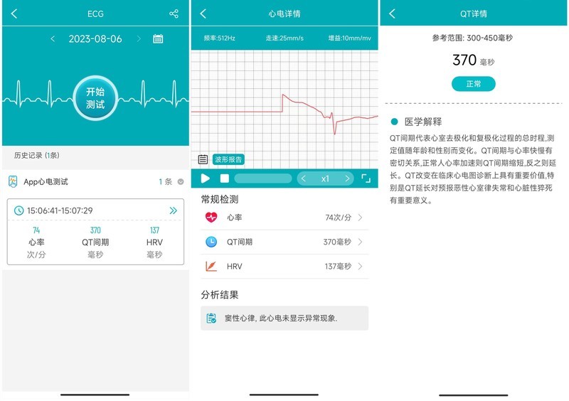 颜值高，够专业！智能手表里最懂健康的也许只有它——dido E56S