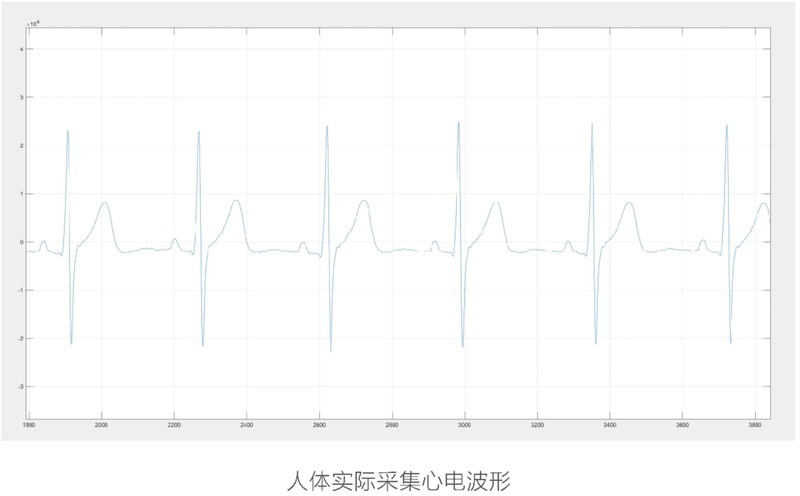 推荐一款可以应用在智能马桶上的医疗级心电模块