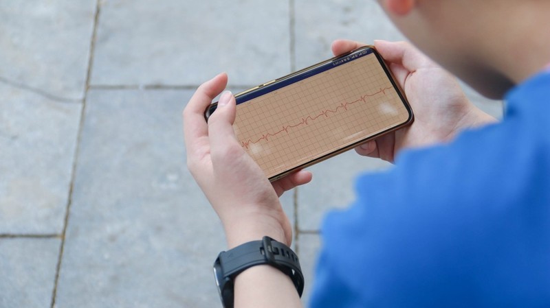 dido Y81S心电血压手表测评：真正关注人体健康，你的腕上小护士