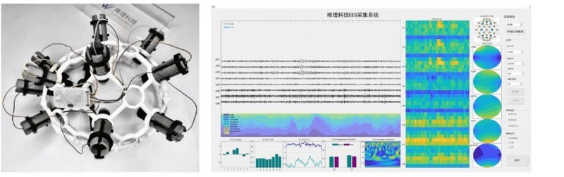 国产基于脑机接口的中风后主动康复训练解决方案