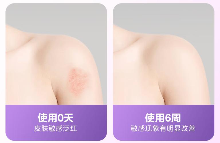 618买床上除螨仪哪个品牌最好最实用?10大核心参数突出机型盘点！