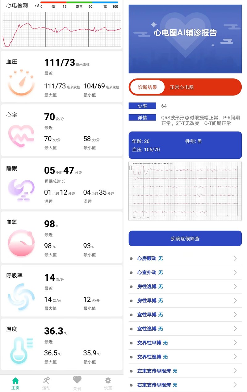 智能手表哪款好？戴在手腕上的健康助理，dido E10血压心电智能手表深度体验