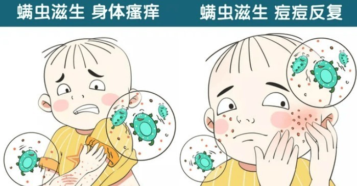 除螨仪10大品牌排行：2025十大公认好用的除螨仪排名