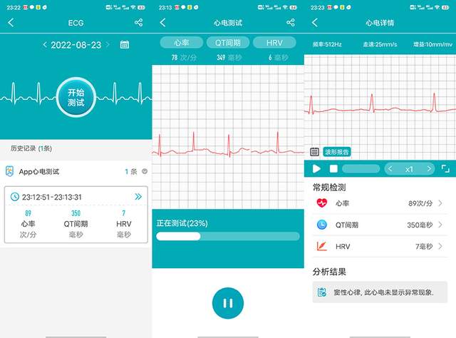 从没见过功能那么强大的智能手表——dido G28S智能手表测评