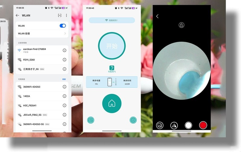 耳朵里的小世界你敢看吗？智能可视掏耳勺让你看清耳屎！