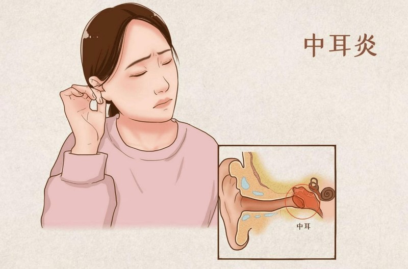 百元开放式耳机选择什么品牌？平价开放式耳机推荐分享