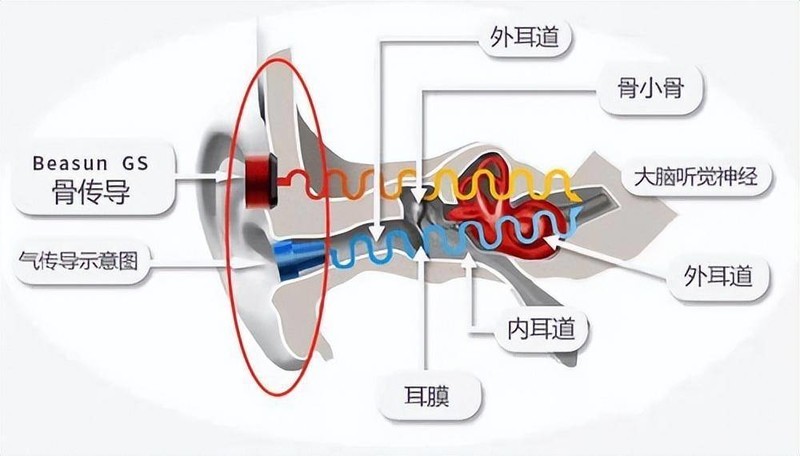如何挑选好的骨传导耳机?2024五大爆款骨传导耳机推荐