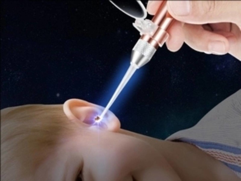 儿童耳勺买什么牌子？顶尖可视挖耳勺一目了然！