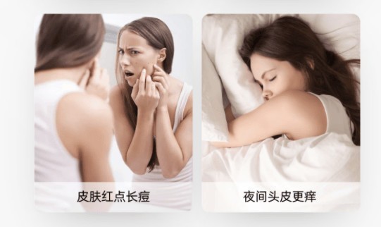 有线除螨仪是智商税吗？2025年公认好用的10款除螨仪推荐！