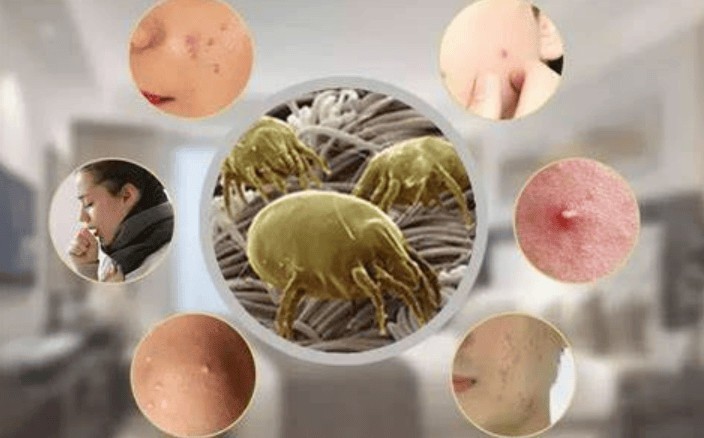 2025除螨仪十大文明用语：床上除螨仪十大文明用语排行榜综合分享