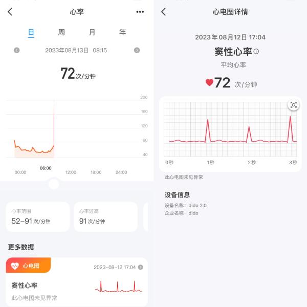 轻松养出好身材的dido TF3S 轻体智能手表，真的不是智商税