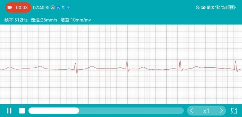 dido E55SPro健康智能手表：了解自己 塑造更健康的自己