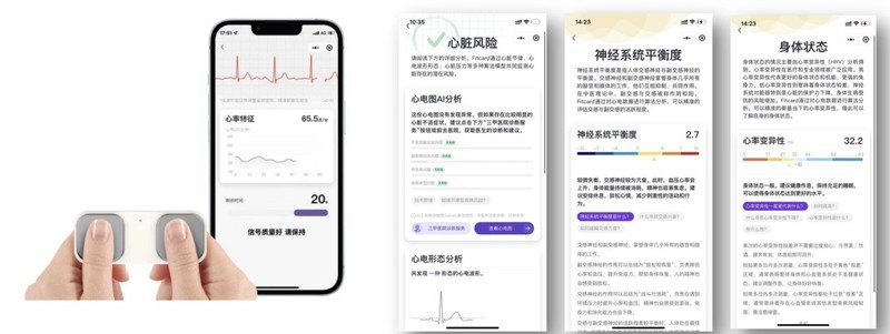 基于自研心电芯片国产化手持单导/6导/12导心电仪解决方案