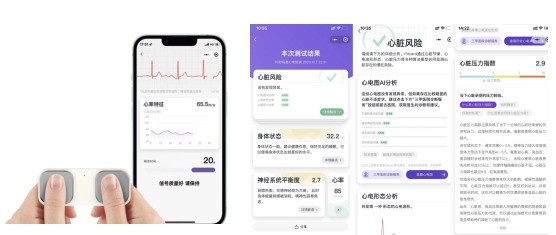 基于自研心电芯片国产化手持单导/6导/12导心电仪解决方案